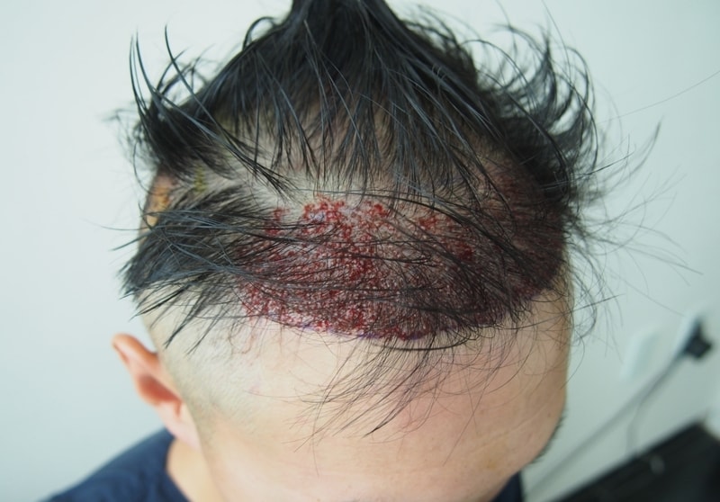 [Mo Jae Sung] Right after the surgery and the hospitalization review