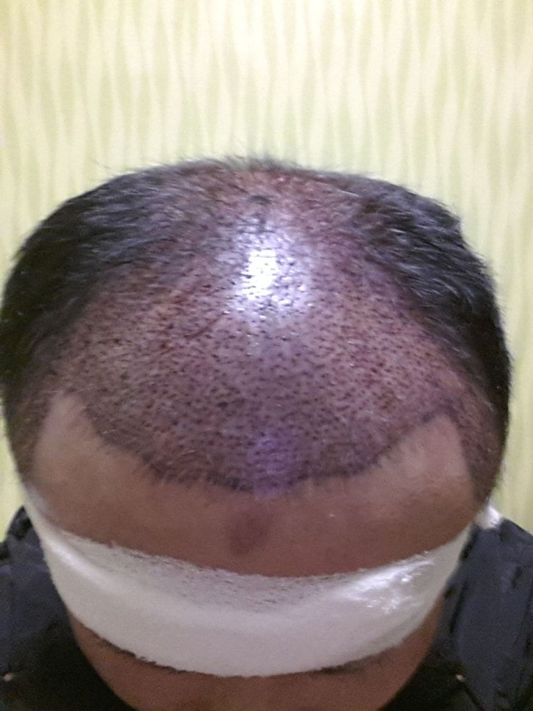 20150507_이식후.jpg