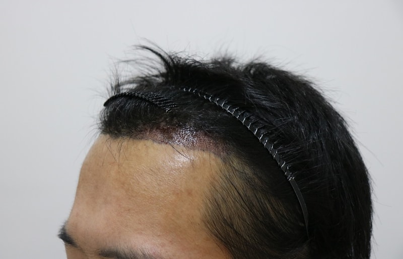 수술후2.jpg