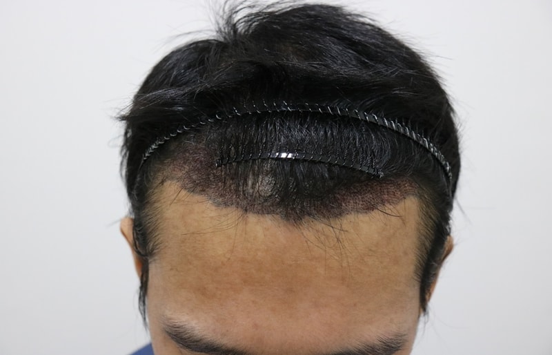 수술후1.jpg