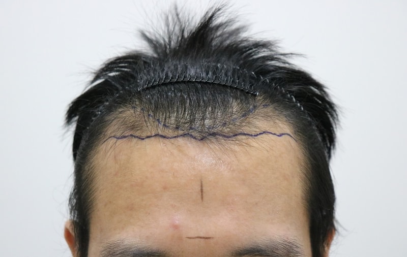 수술전1.jpg