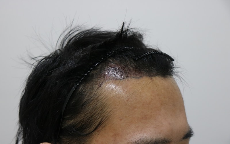 수술후3.jpg