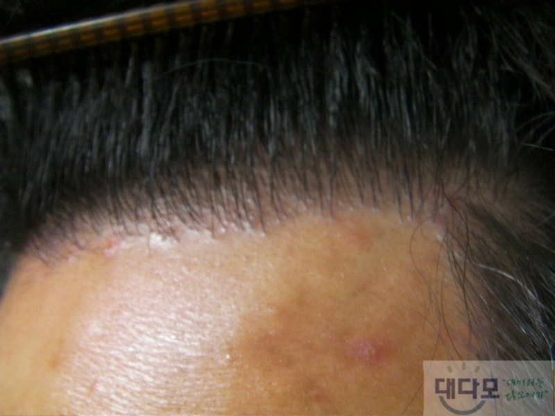 수술4.jpg