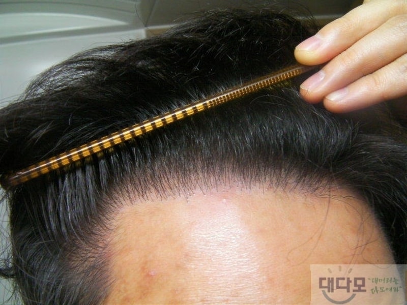 수술3.jpg