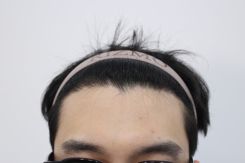 후1.jpg
