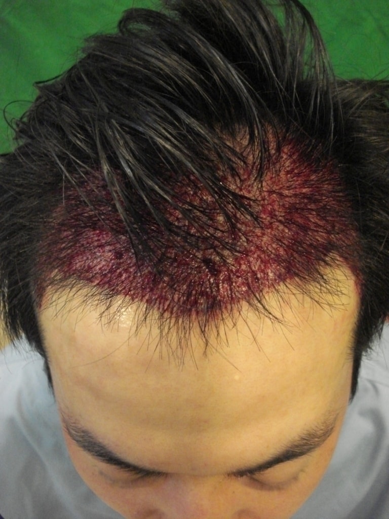 수술후.jpg