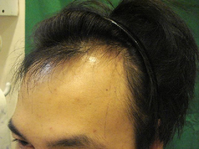 수술전_02.JPG.jpg