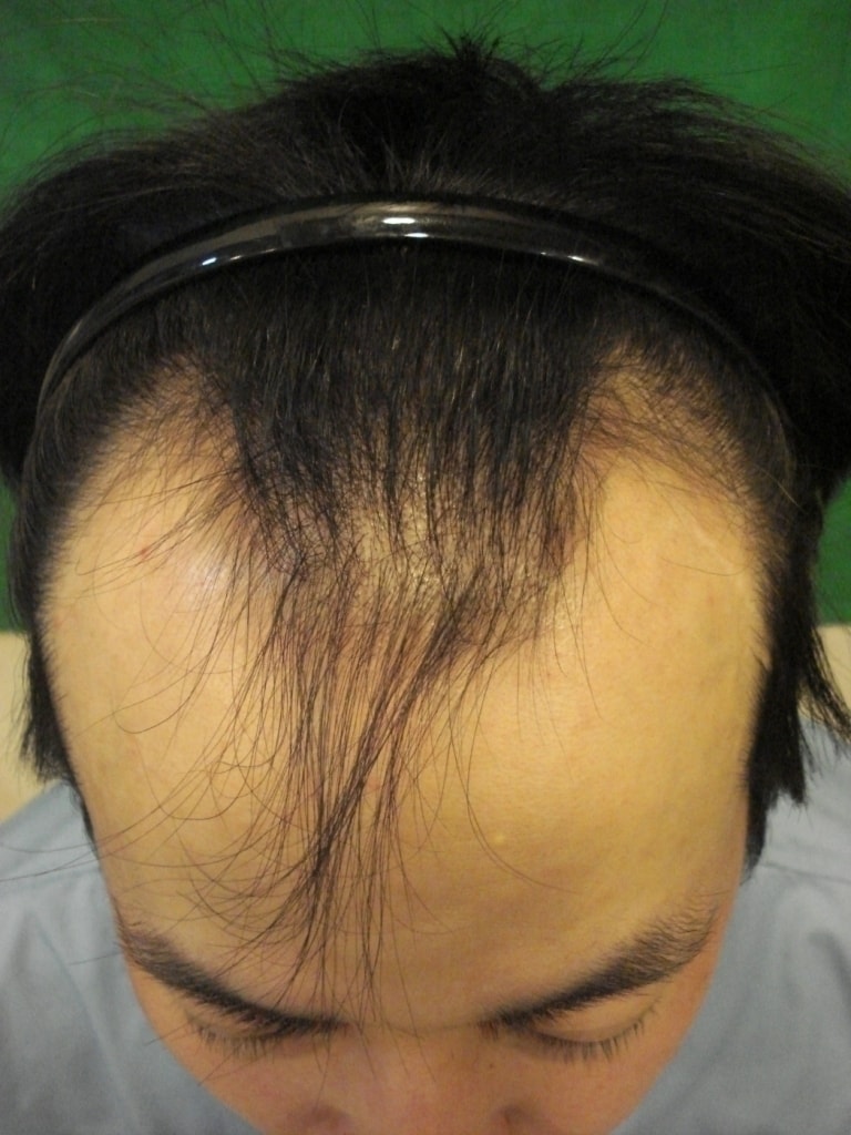 수술전.jpg