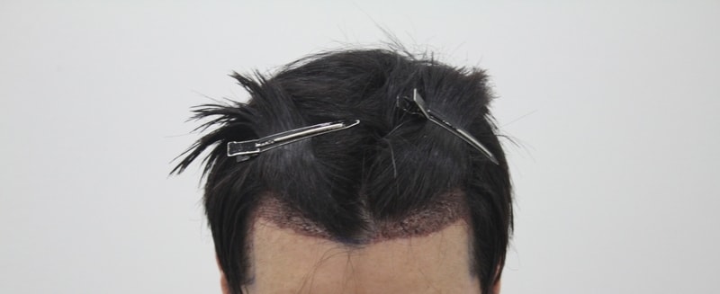 샴푸후1.JPG