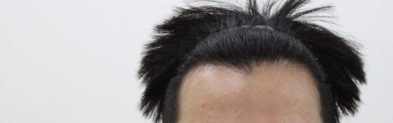 수술전1.JPG