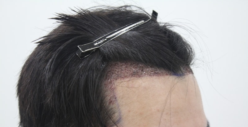 샴푸후5.JPG