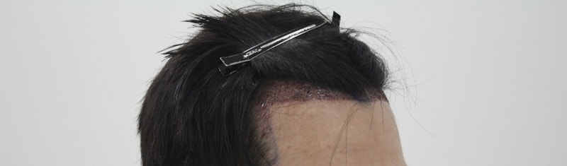 샴푸후4.JPG