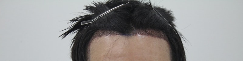샴푸후2.JPG