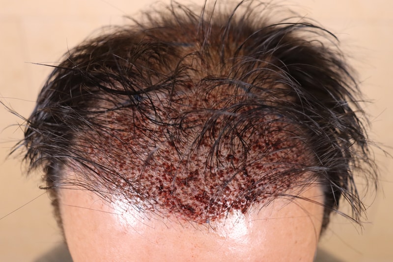 포토후기 이미지