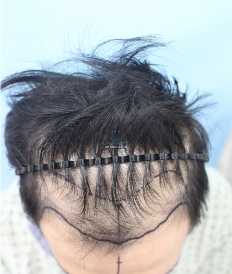 ced26736eb2af06f198964eae81197df.png