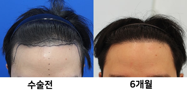 포토후기 이미지