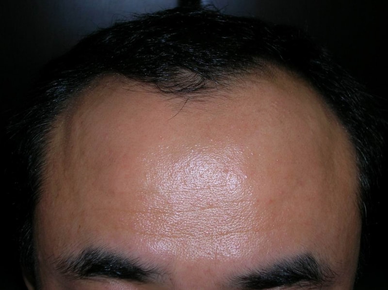 1.front.jpg