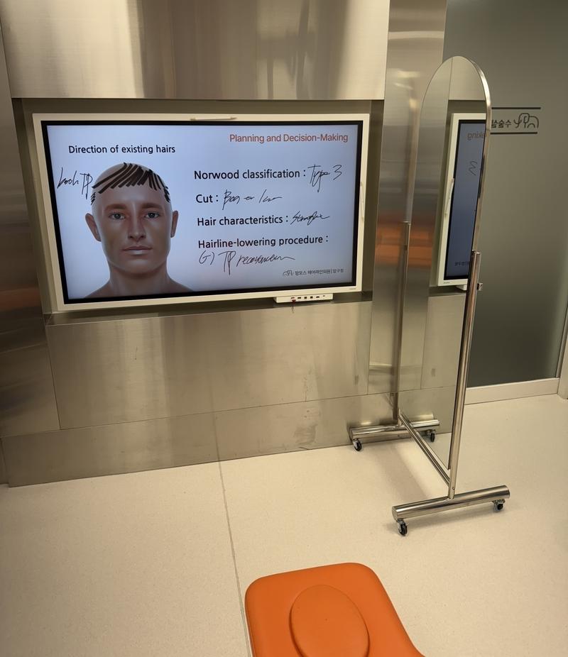 [Apgujeong Mammoth Hairline Clinic] This is the first day review of the hair transplant slit.