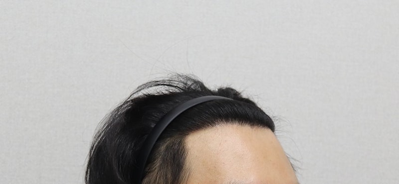 1년 후_업로드용3.jpg