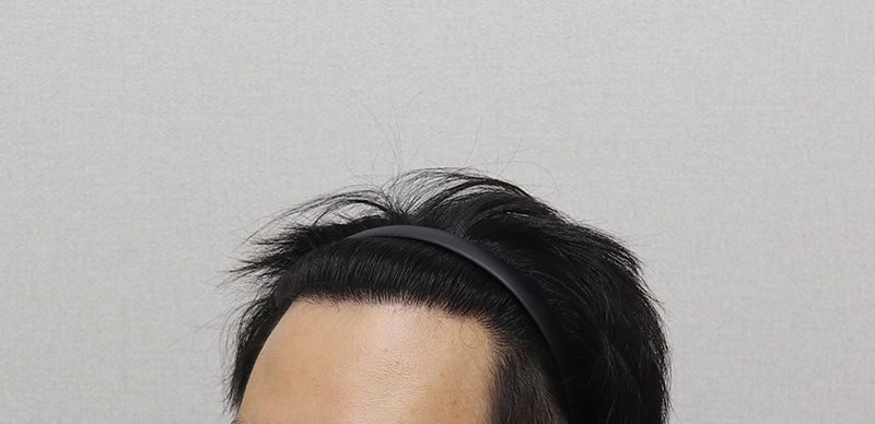 1년 후_업로드용2.jpg
