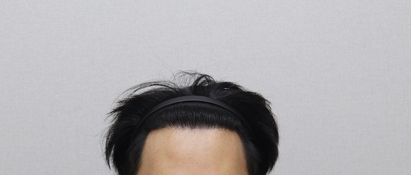 1년 후_업로드용1.jpg