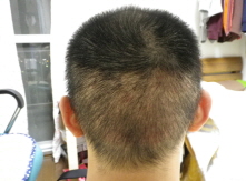 수술후30일째 (2).JPG