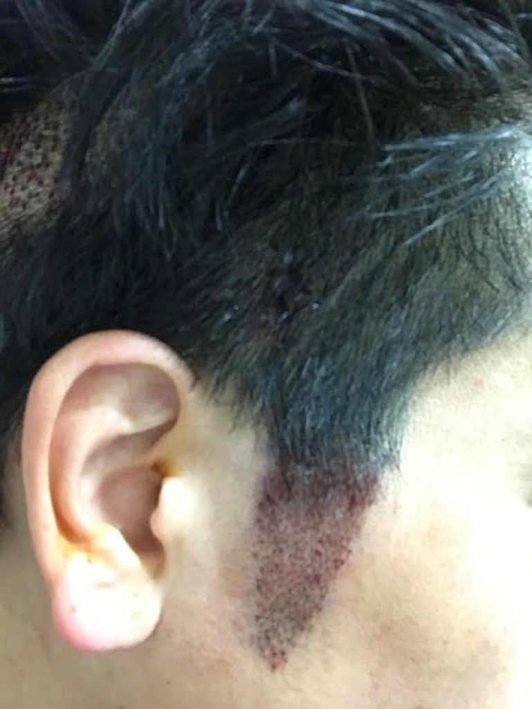 This is the review of the second week of Mo Jae-sung. (Sideburns, eyebrows, soldering)