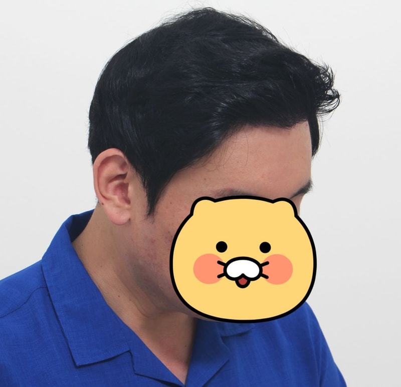 07.수술10달.jpg