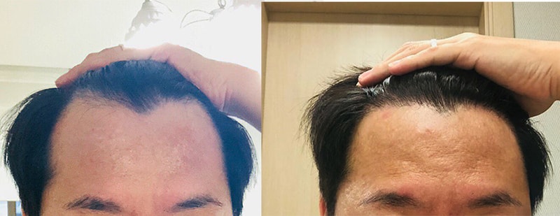 전후비교.jpg
