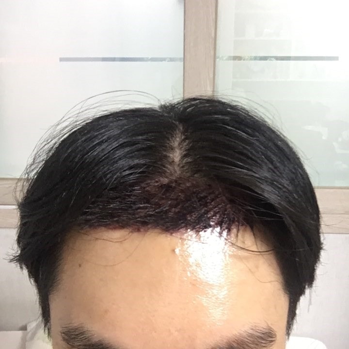 2일차 저녁정면위.jpg