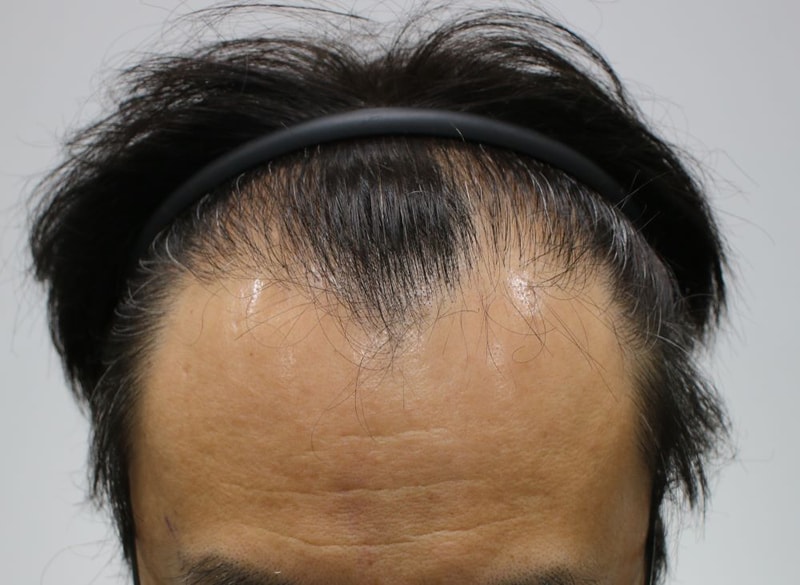 04_수술전.JPG