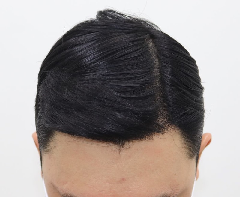 01_수술후.JPG