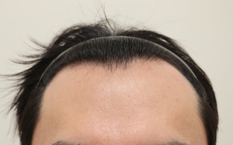 5개월차 달성했습니다^^