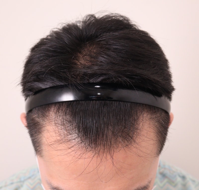 1. 수술전_2.JPG