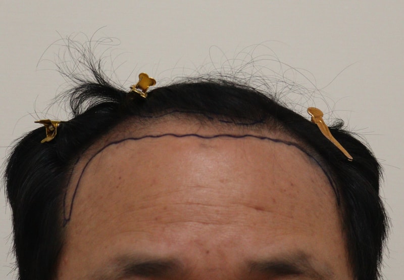 포토후기 이미지