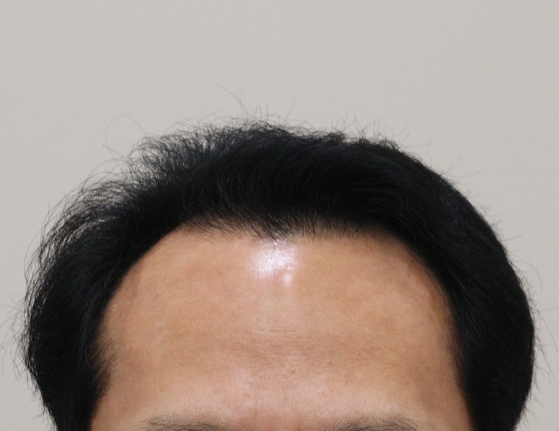 내년에는 풍성한 머리를 기대해도 되겠죠