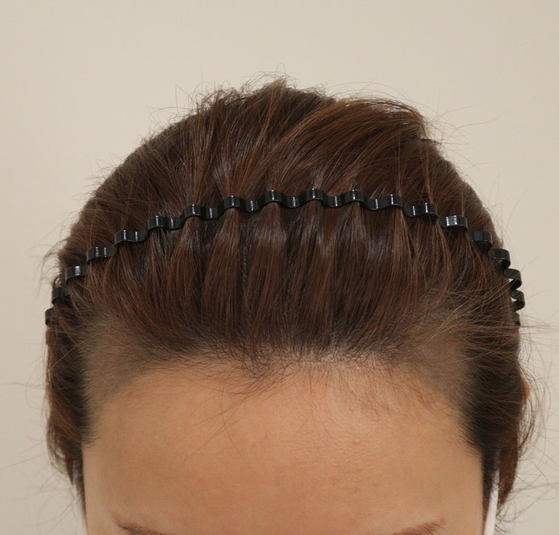 1. 수술전_2.JPG