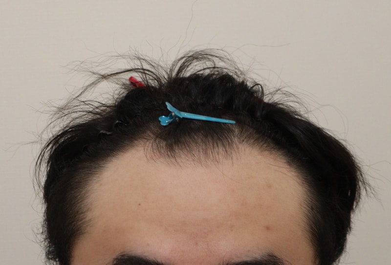 서울로가서 하길 잘했네요~