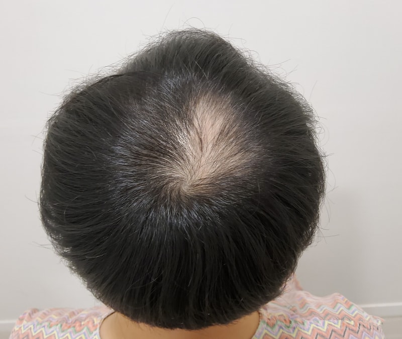 0. 수술전_2.jpg