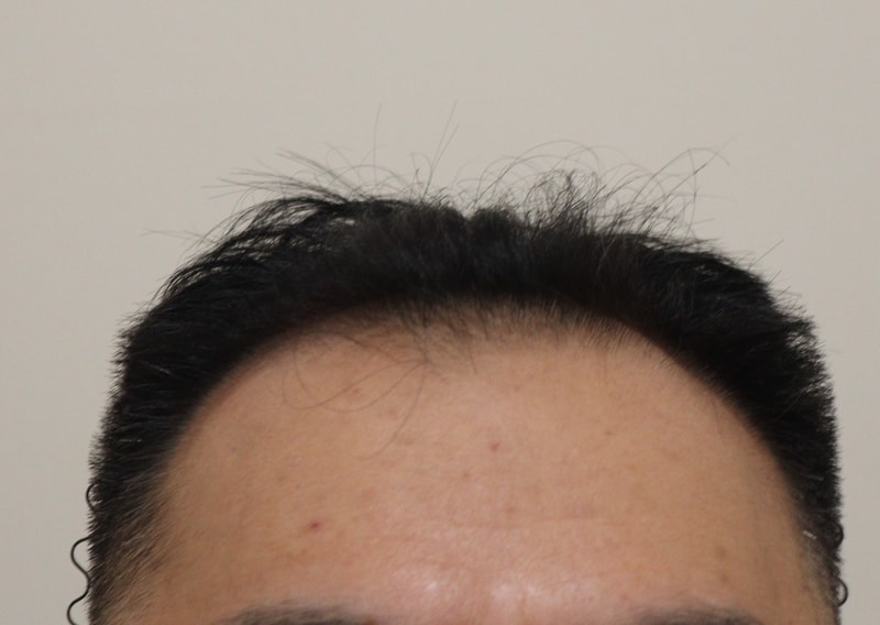 6개월차 후기입니다.