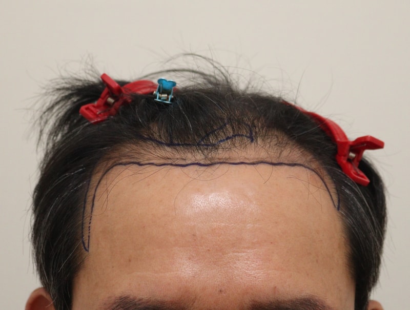 포토후기 이미지