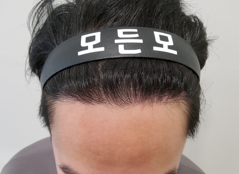3. 수술후_1년.jpg