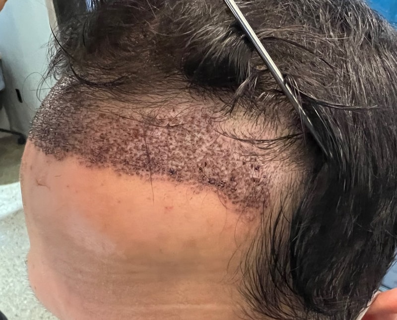 2. 수술후_1일_2.jpg