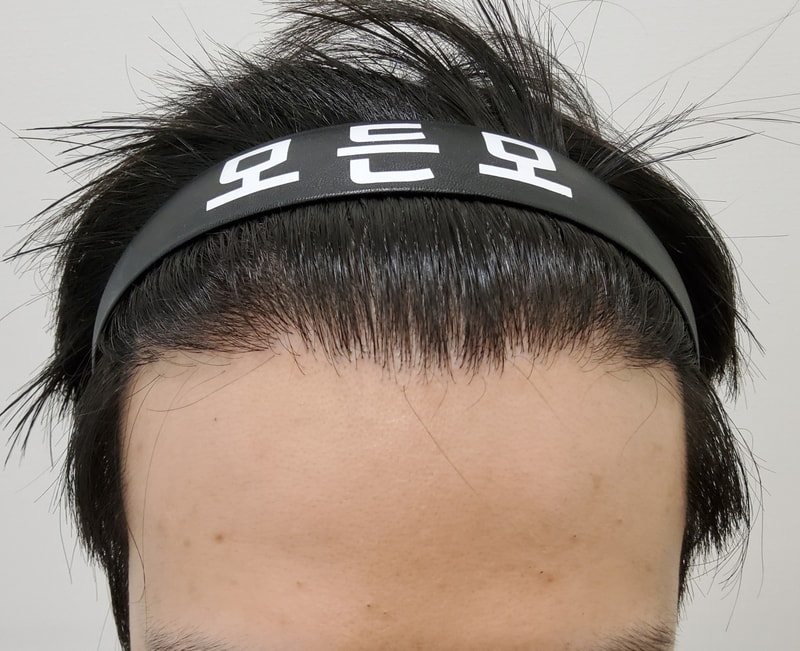 4. 수술후_3개월_1.jpg