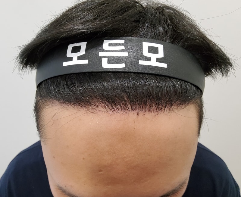 4. 수술후_6개월_1.jpg