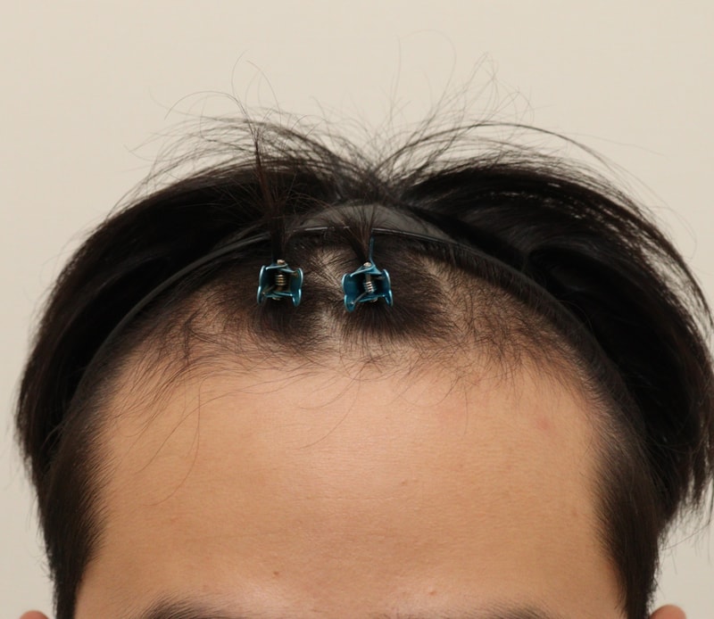 暗黒期が過ぎて光を見ています！