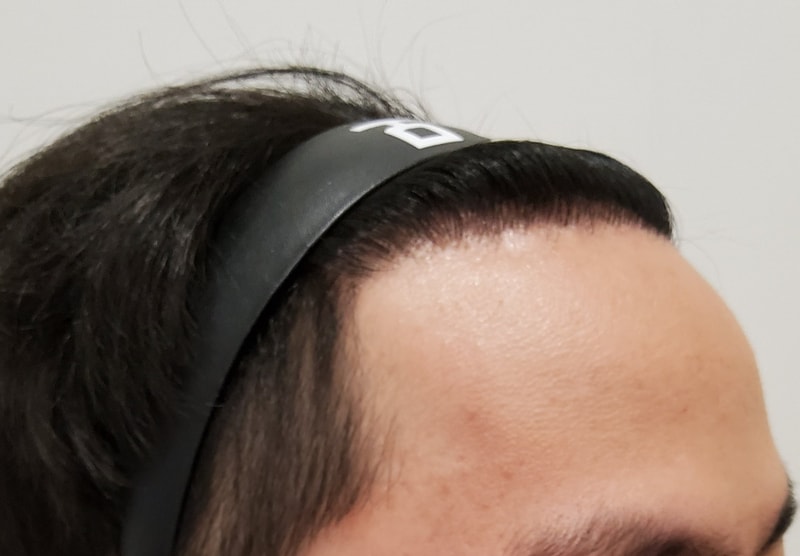 6. 수술후_1년_2.jpg