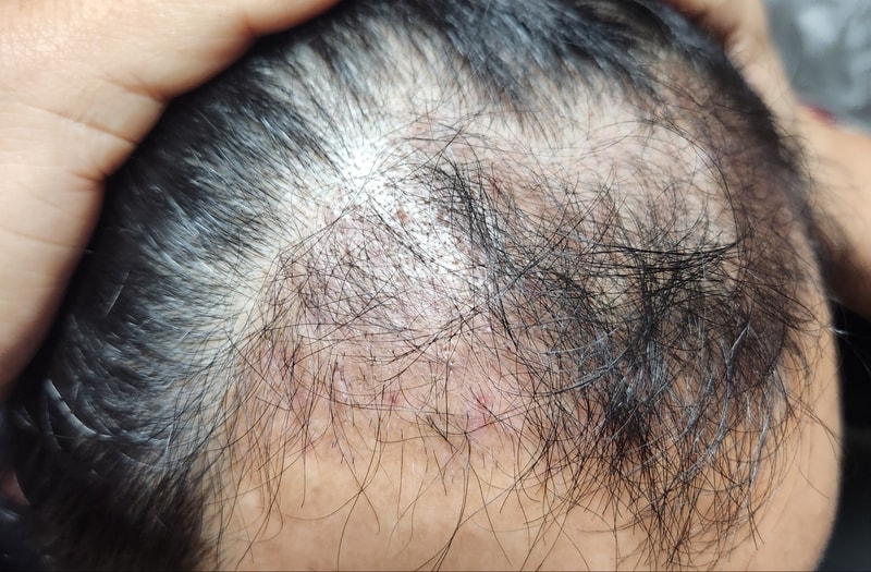 3. 수술후_3개월_셀카_3.jpg