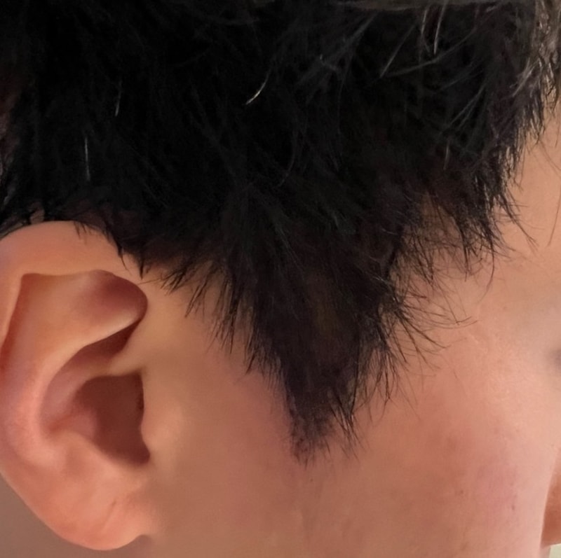 2. 수술후_1일_3.jpg