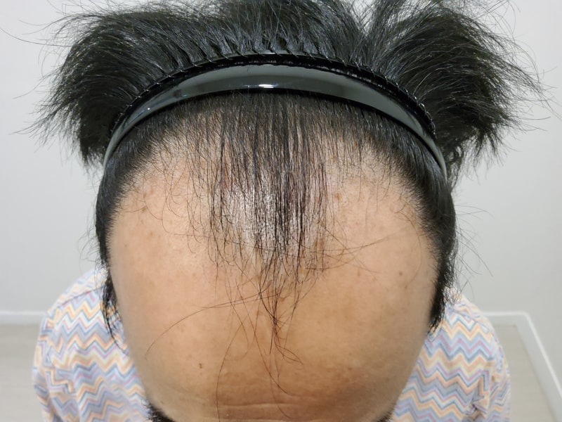 포토후기 이미지